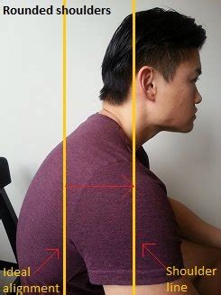 posturedirect|posture direct rounded shoulders.